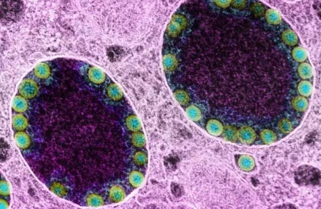 世衛：英國研究發現新變種病毒XE 較Omicron傳播快10%