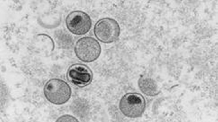 全球首例 意大利男子同時染猴痘新冠愛滋病毒
