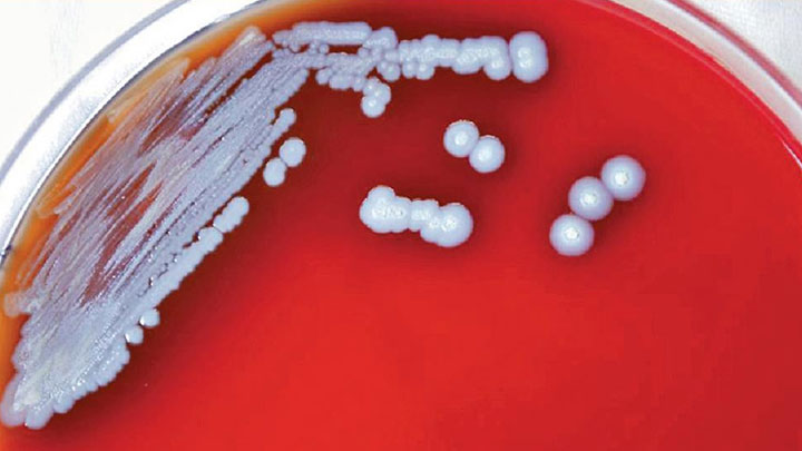 91歲類鼻疽男病人離世 本港今年累計10人病歿