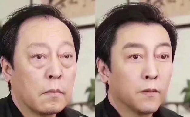 你的眼袋比苏大强的还大 这可怎么办啊