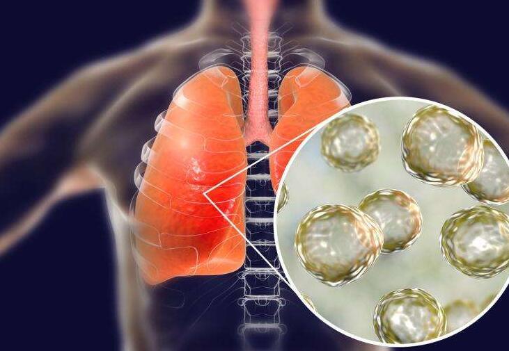 新型肺炎纳入乙类传染病、甲类管理 与“非典”同级