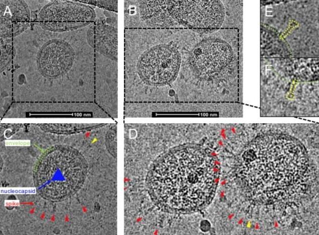 深圳首次揭秘灭活新冠病毒真实形貌