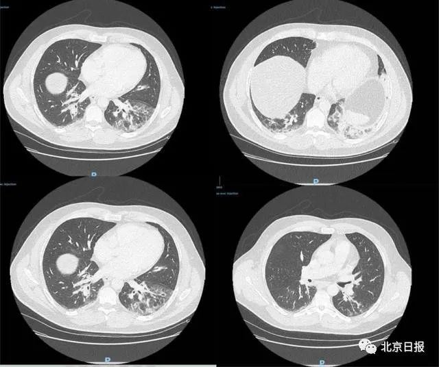 多国研究证实！关于病毒源头，我们越来越接近真相