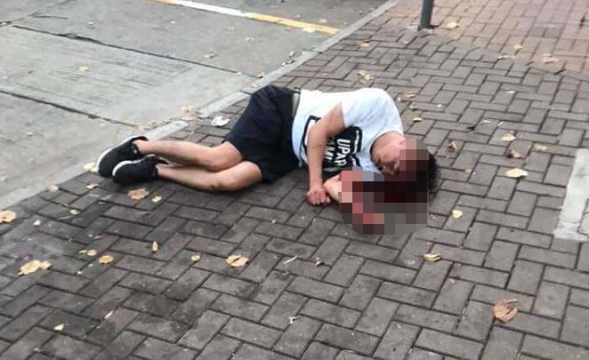 遭5名刀手追斬 男子頭中2刀血流如注