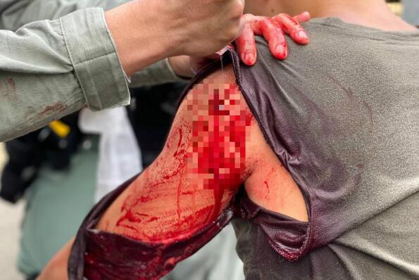 被刺傷警员疑遭醫護不公對待 警方：已嚴肅跟進