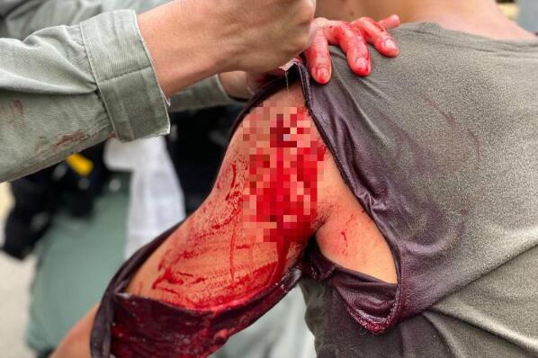 7·1刺傷警員案再有兩人被捕 涉非法集結及拒捕