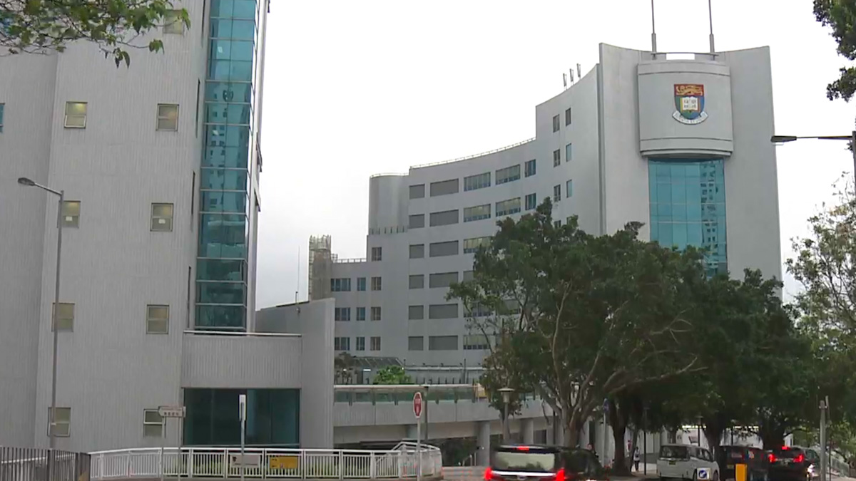 港大：新冠後遗症甚於SARS 病毒感染人腦恐致癲癇