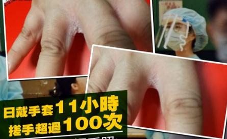 日戴手套11小時搓手超100次 檢測護士:少少痛楚我會承受 過嚟做檢測好嗎？