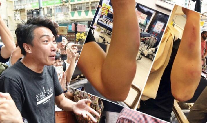 岑子杰遇襲案2名被告認罪 押後至21日判刑