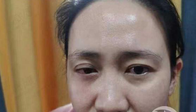 武漢醫生艾芬手術後右眼近乎失明 愛爾眼科：赴武漢調查