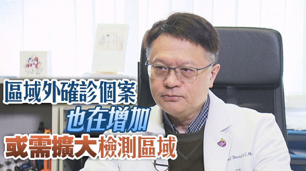 許樹昌：建議再做大型檢測時應縮短通知時間 