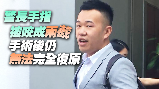 涉咬斷警長手指 男子4項罪成即時還柙