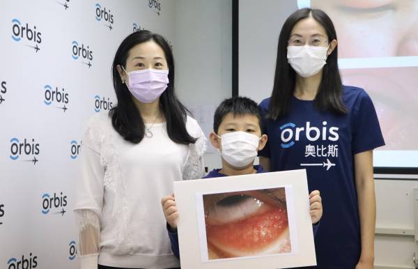 奧比斯調查：8成學童有眼敏感徵狀