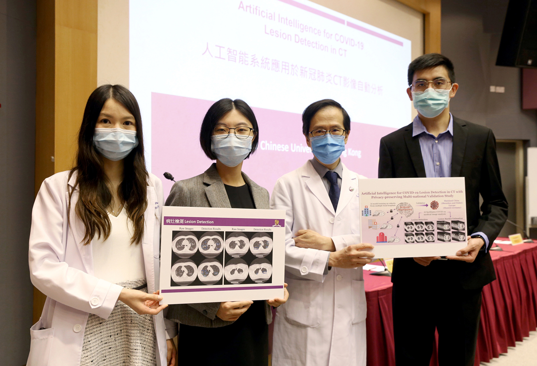 有片 | 中大團隊開發新一代人工智能系統 可自動分析新冠肺炎CT影像