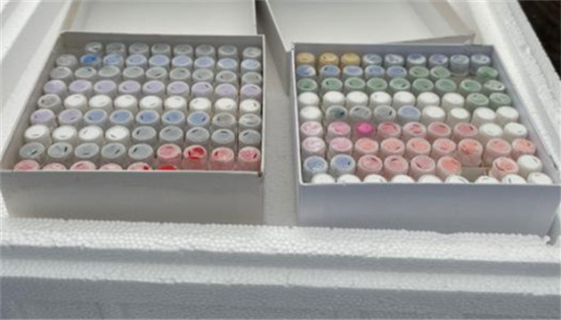 上海海關截獲夾藏走私進境的「人體細胞」247支