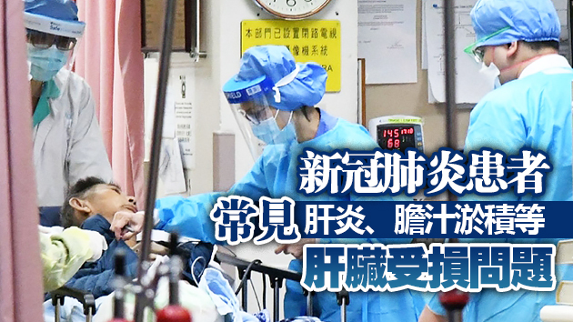 中大研究指乙肝患者若感染新冠肺炎不會增加肝受損風險