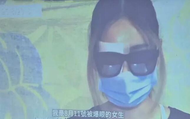 【名家指點】「爆眼事件」說明什麼