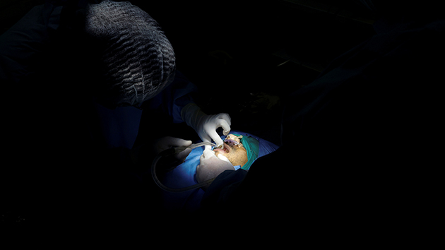 黑白黃綠真菌肆虐印度 3染疫兒童需摘除眼球保命