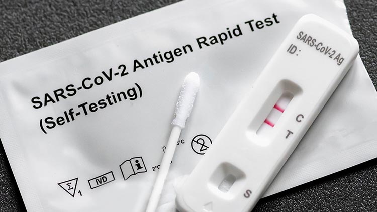 商經局：已接收經中央協調採購快測包逾1.9億份及3.5億個口罩