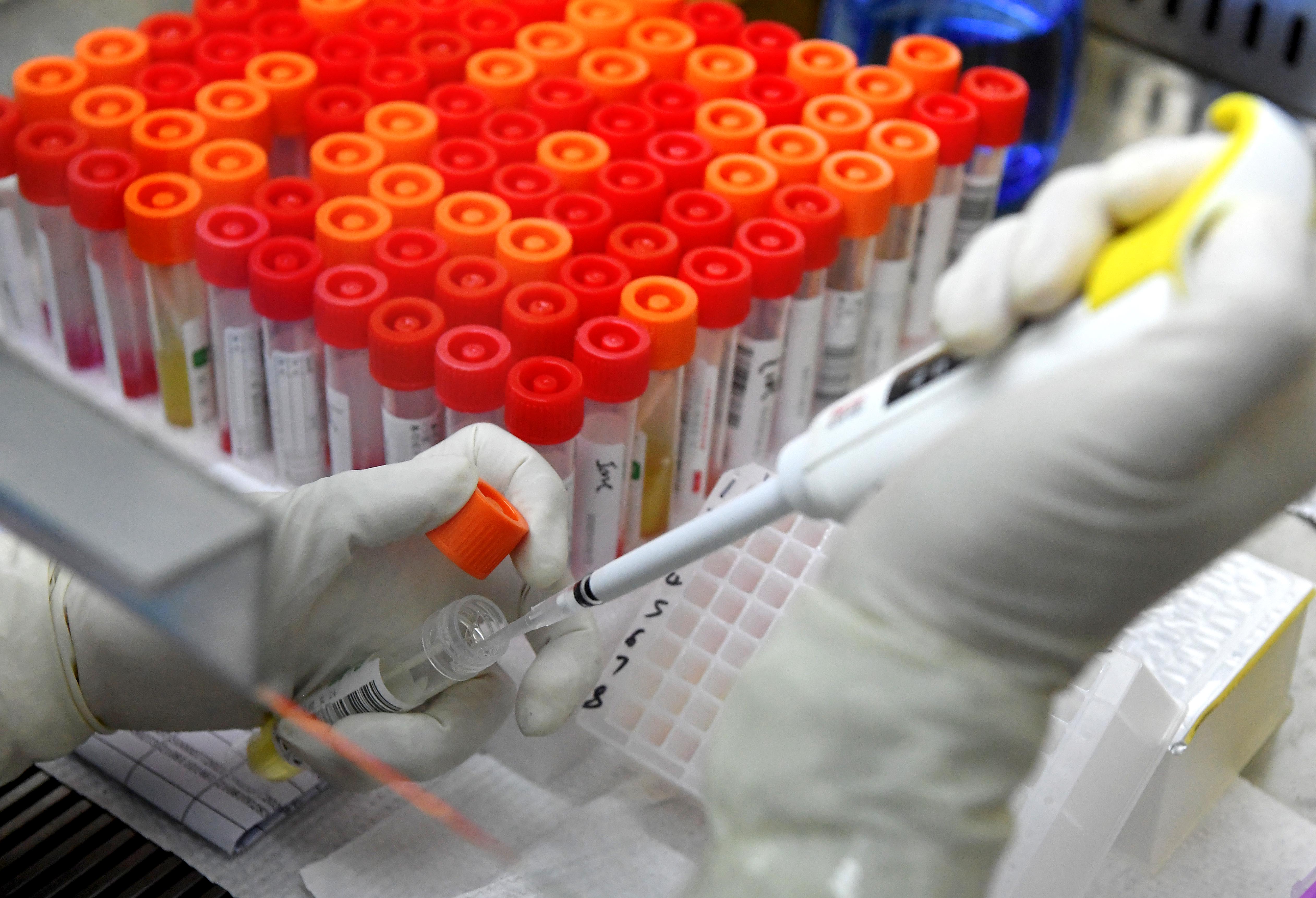 4月14日深圳在外省來深人員排查中發現8例新增病例