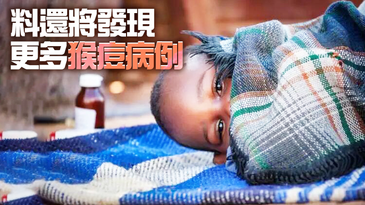 世衛將猴痘的全球公共衛生風險評估為中等