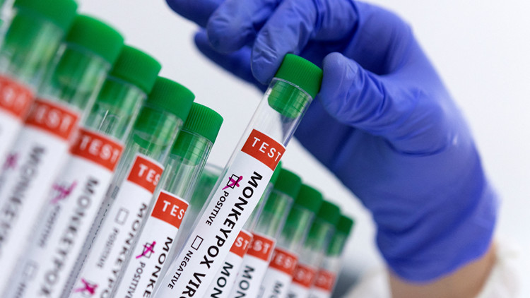 中國疾控中心：中國有能力及時發現潛在輸入的猴痘病例