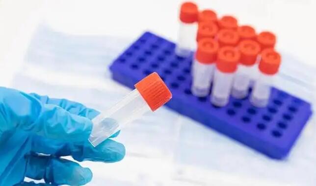 深圳市南山區新型冠狀病毒肺炎疫情防控指揮部辦公室通告(第108號)