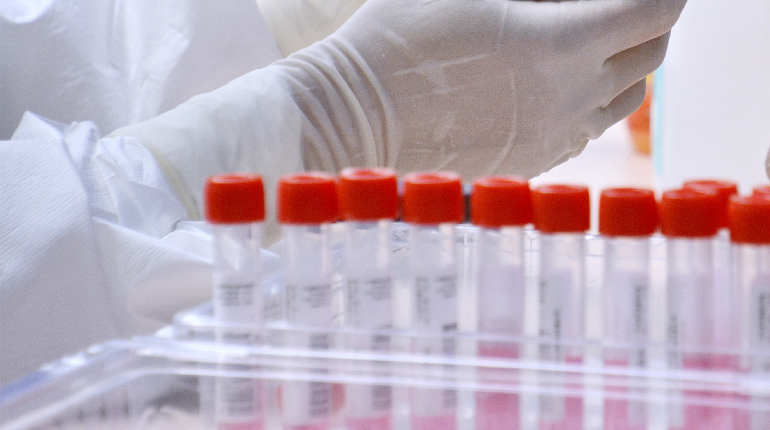 8月20日深圳在外省返深人員和主動就診人員中各發現1例 在已隔離觀察的密接人員中篩查出9例