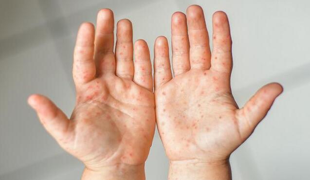 升至中風險！深圳疾控發布重要提醒