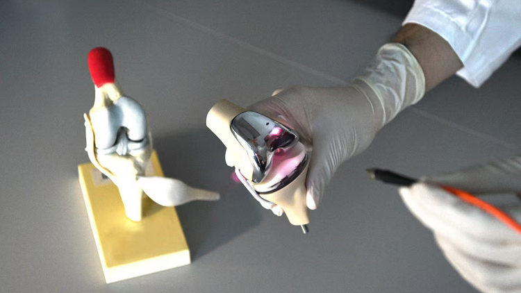 港大醫學院首創光電流感應塗層 骨科手術植入物兩周可融合 速度快一倍