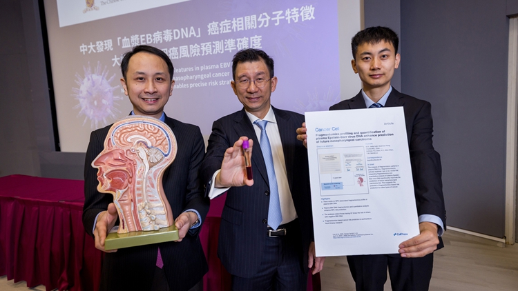 中大成功識別血漿EB病毒DNA 大幅提升鼻咽癌風險預測準確度