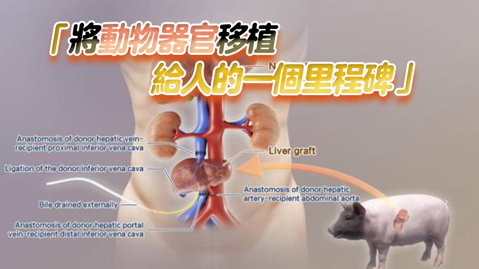 全球首例！中國團隊成功將基因編輯豬肝臟移植人體