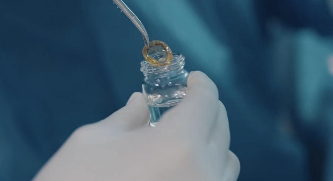 愛爾眼科已在全國16省建立62個角膜捐獻接收登記站 