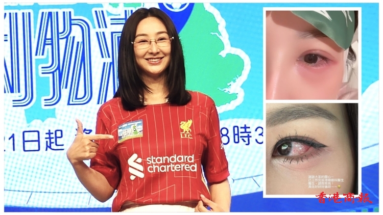 有片丨【娛樂】高海寧素顏現身：中西合璧治眼疾 康復八成進度良好