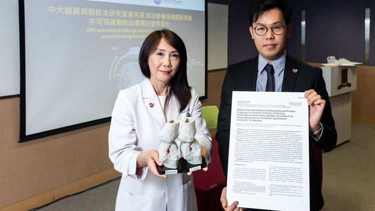 中大銀屑病關節炎研究重要突破 成功修復受損關節骨頭