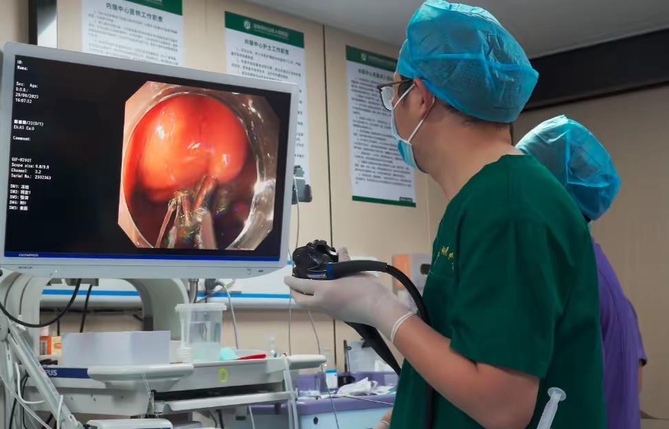 深圳市坪山區人民醫院消化內科成熟開展「內鏡下主動穿孔超微創手術」切除胃腫瘤